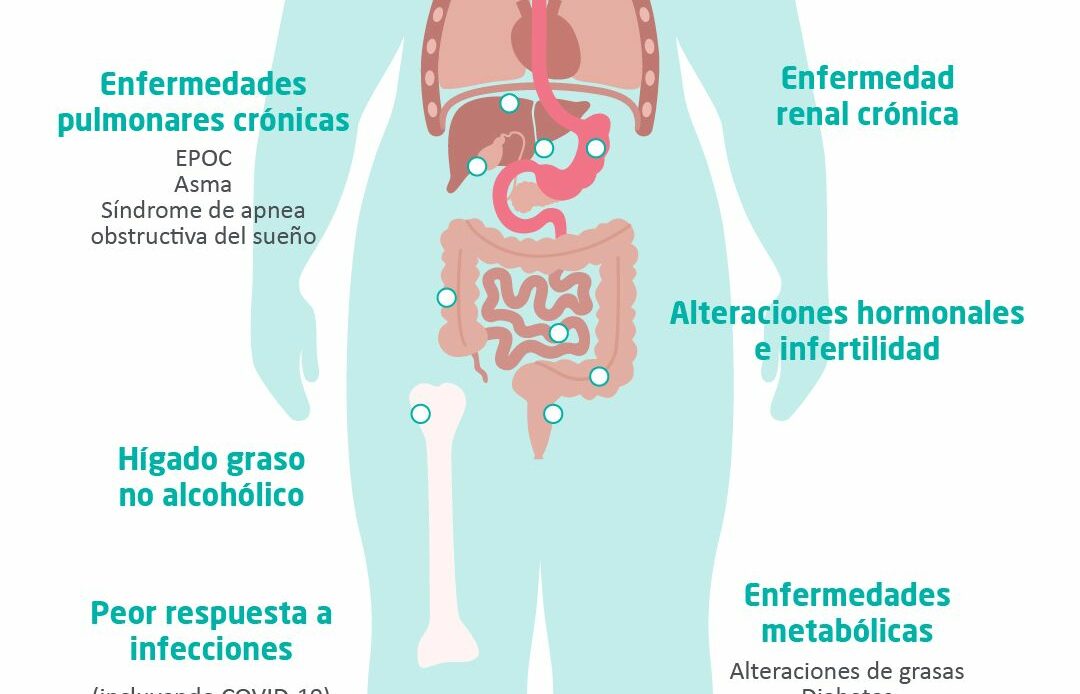 «La obesidad está muy relacionada con la infertilidad», Dr. José María Vítores