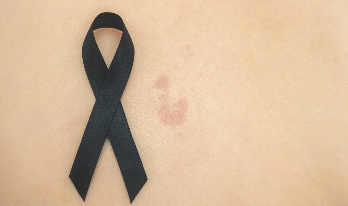 «Exponerse al sol sin protección puede tener consecuencias graves tanto a corto como a largo plazo», explica la dermatóloga Maribel Martínez