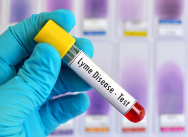 Pruebas para detectar la enfermedad de Lyme