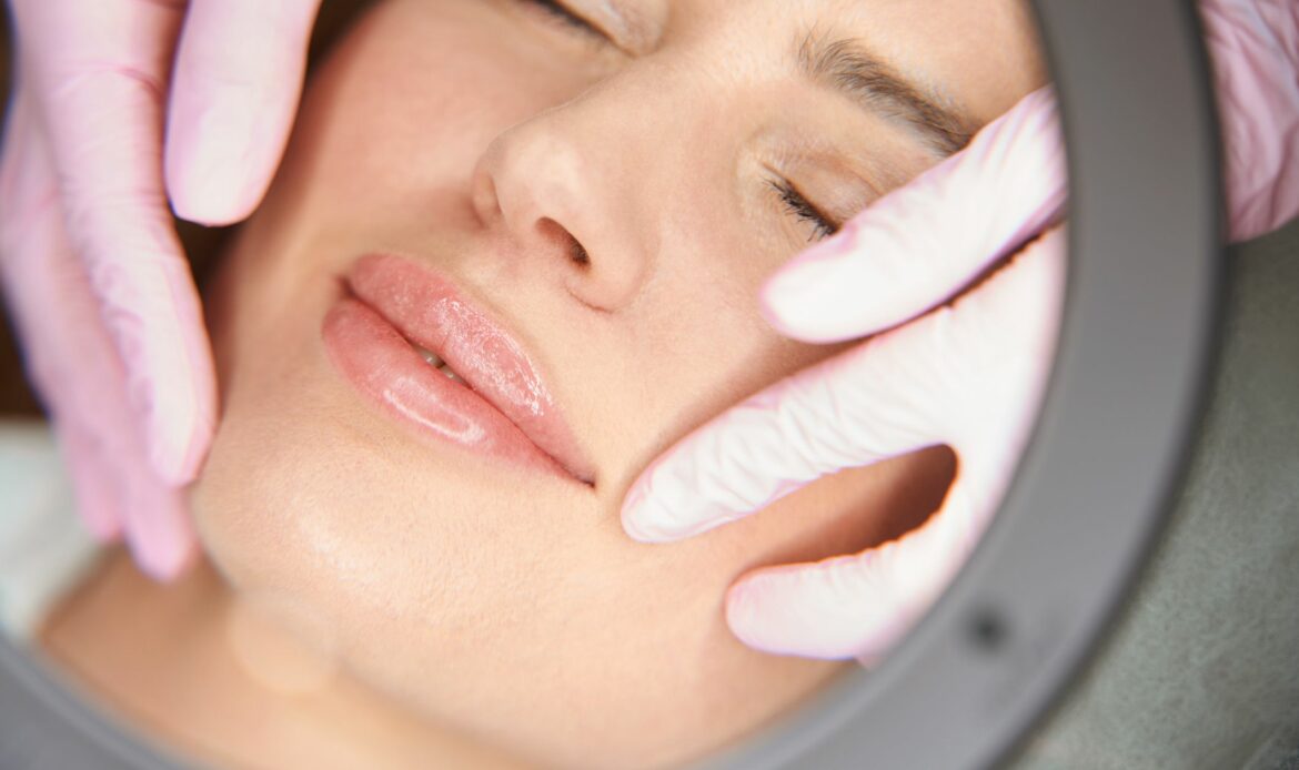 Clínica Ibiza explica qué es el lip lift o cirugía de labios, y para quién se pauta